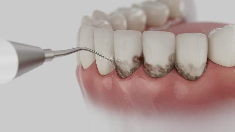 Reliable Dental contractor in Williamsport, IN by Dentist Open Now